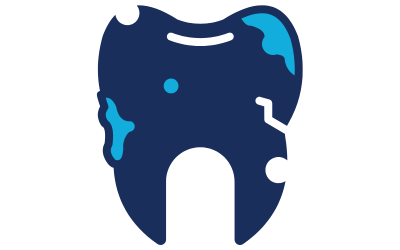MI治療のメリット、むし歯の再発リスクを軽減