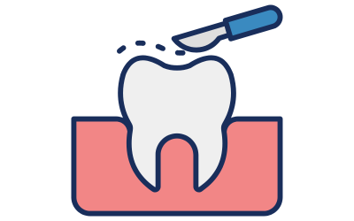 MI治療のメリット、破損しても修復できる